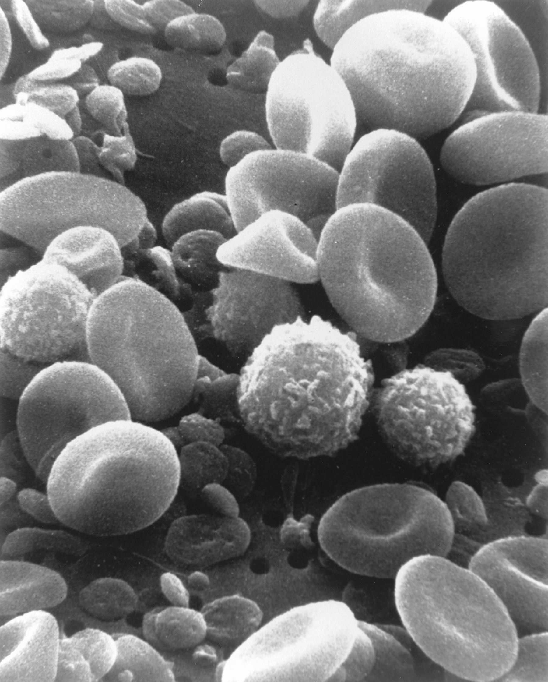 Stem cell electron microscopy